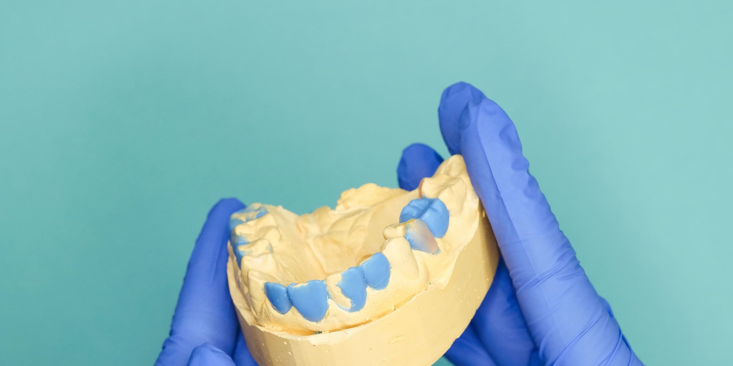 Blue-gloved hands holding a dental mould